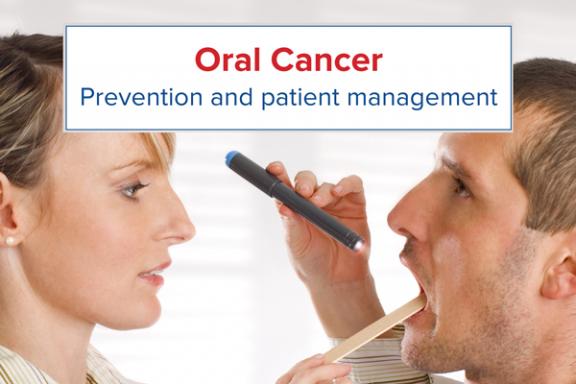 Oral cancer chairside guide now available online | FDI